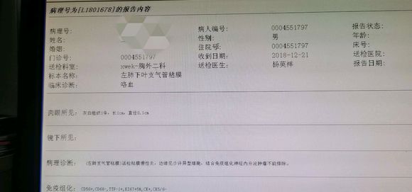 求助小细胞肺癌治疗方法