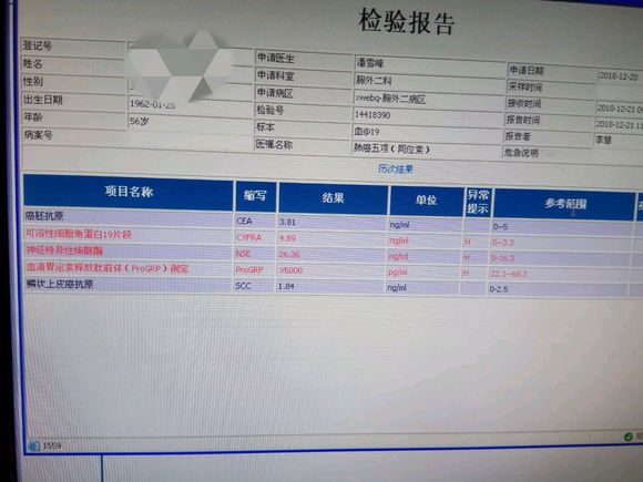 求助小细胞肺癌治疗方法