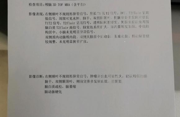 父亲最近因肺腺癌脑转引发癫痫住院