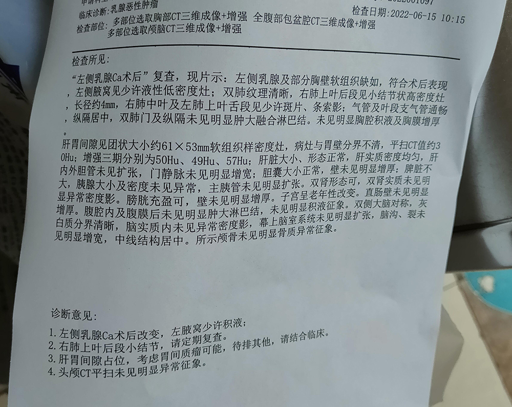 我外婆做的CT有人帮忙看看吗