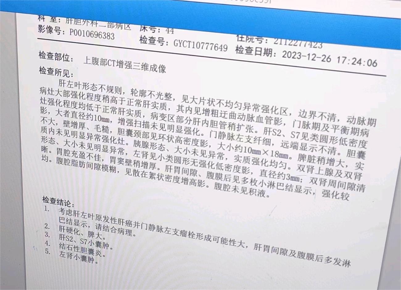 肝癌，突来的变故